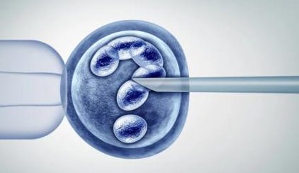 2026年美国试管婴儿移植的费用是多少？