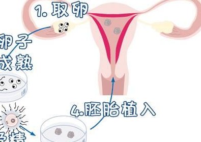 确诊为免疫性不孕能在苏州市做试管婴儿吗？做三代试管需要多少钱？